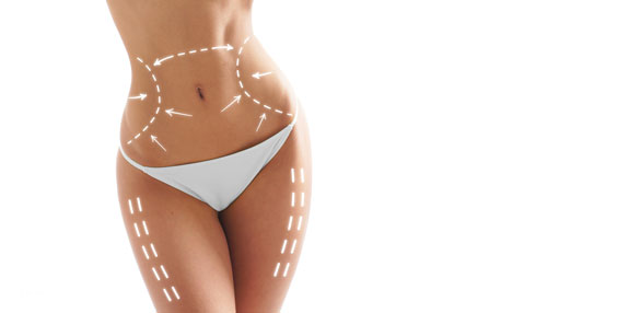 Fettabsaugung Dachau